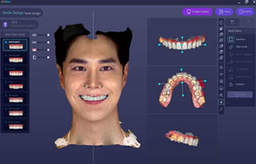 교정 후 모습을 미리 보여 주는 가상 3D 시뮬레이션 화면